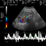 Why Does the Texas Legislature Believe That Embryos Have a Heartbeat?