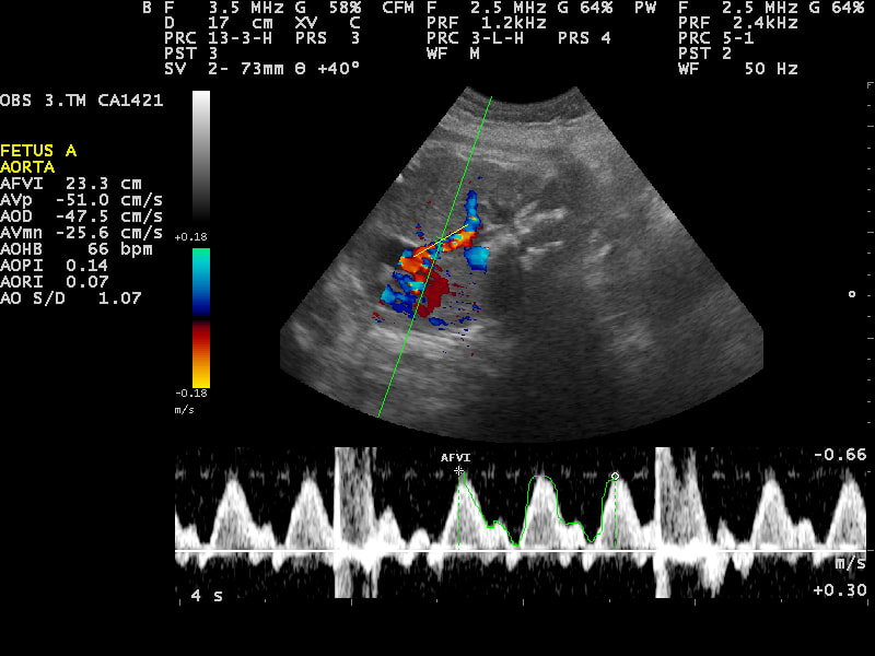 Ultrasound scan Image credit: Nevit Dilmen/Wikimedia Commons