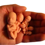 How Fetal Politics Stole Americans’ Reproductive Rights